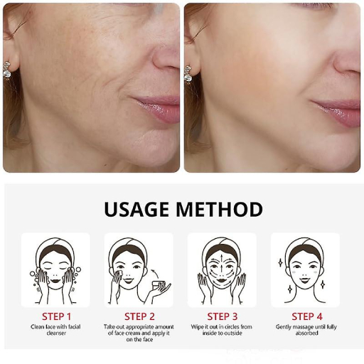kojic acied cream