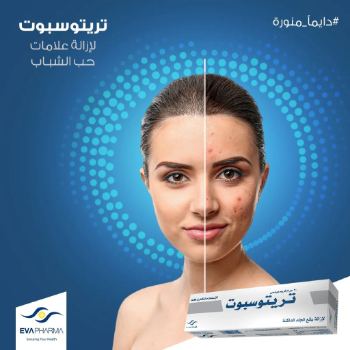 Tritospot Cream Removes Dark Spots From The Skin. Tritospot Cream Removes Dark Spots From The Skin.